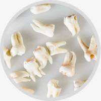 Knocked Out Teeth Repair